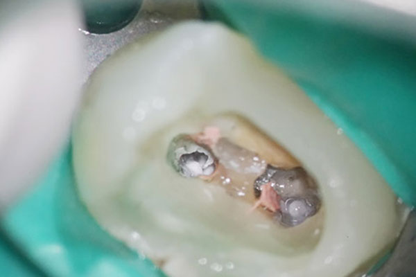 マイクロスコープ